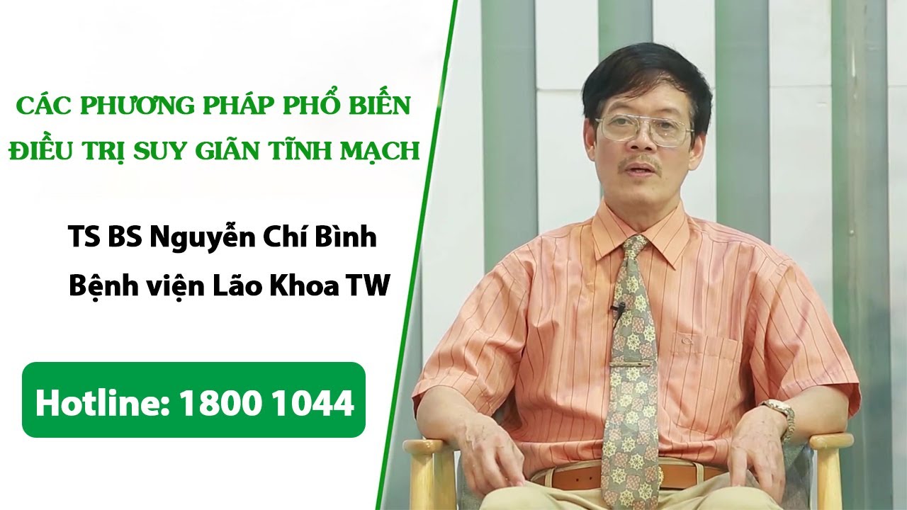 VTV2 – Các phương pháp phổ biến kiểm soát suy giãn tĩnh mạch