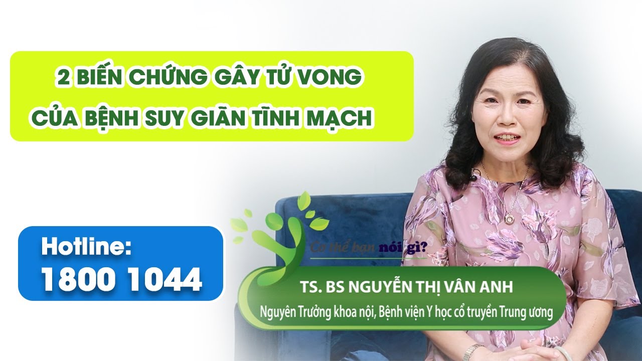 VTV2 – 2 biến chứng gây tử vong của bệnh suy giãn tĩnh mạch